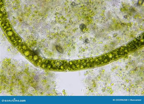  Yellow-green Algae! A Microscopic Marvel Hiding in Plain Sight