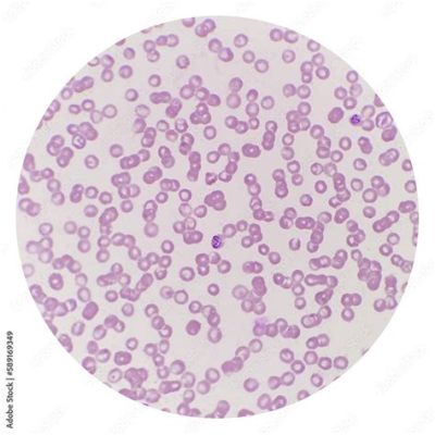  Babesia! A Tiny Parasite That Wreaks Havoc on Red Blood Cells