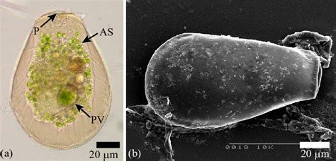  Hyalosphenia! A Microscopic Masterpiece That Swims With Elegant Spikes