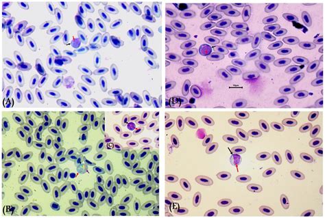   Leucocytozoon! A Microscopic Assassin Lurking Within Avian Bloodstreams