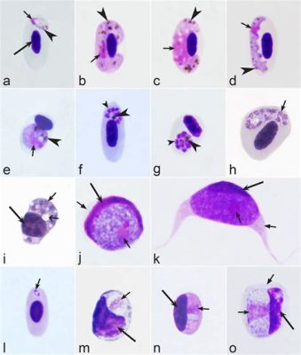  Leucocytozoon! A Tiny Parasite That Wreaks Havoc on Avian Immune Systems