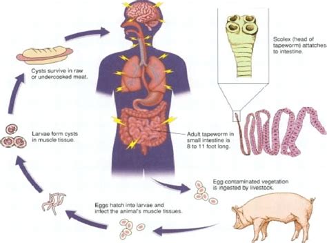  Taenia Solium!  A Parasitic Tapeworm With a Complex Life Cycle That May Just Surprise You!