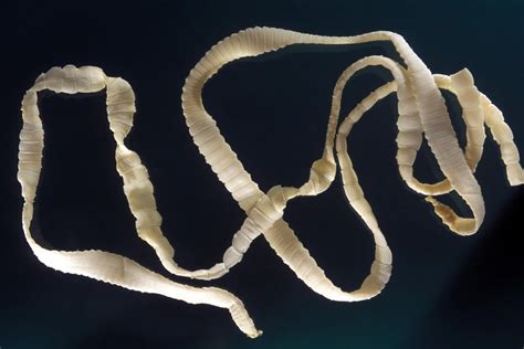  Taenia solium:  A Tiny Tapeworm That Packs A Powerful Punch For Your Gut Health!