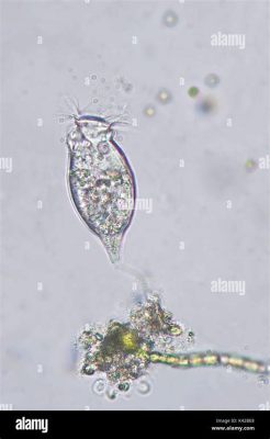  Vorticella! A Tiny Tornado Swirling Through Freshwater Ecosystems